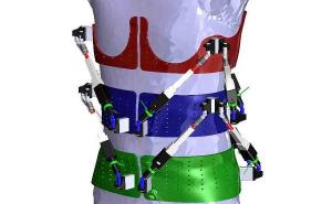 Robotic spine exoskeleton could help treat deformities