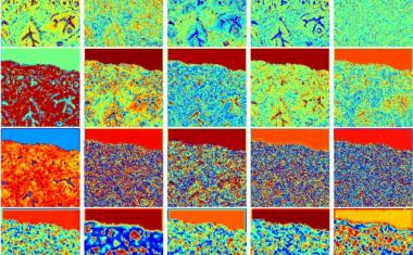 Deep learning accurately stains digital biopsy slides
