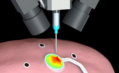 3D printing sensors on expanding organs