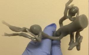 “Medical 3D printing is a game changer”