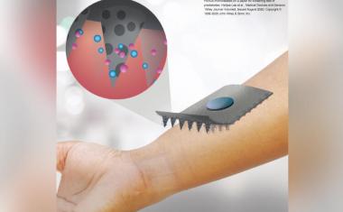 Diabetes: Painless paper patch test uses microneedles