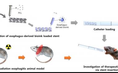 3D printed stents treat inflammation