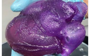 Bioprinted heart provides new tool for surgeons