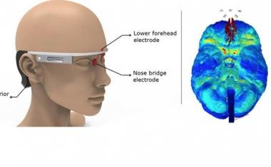 Wearable stimulator to zap Alzheimer's disease
