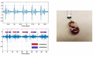 Wearable electronics for cardiac monitoring