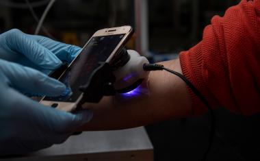 A 'smart' sensor bandage for chronic wounds