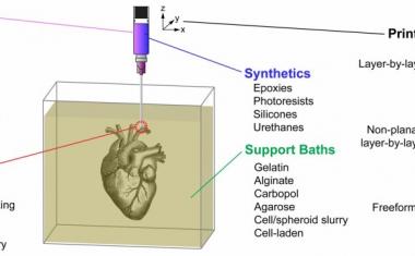 A 'FRESH' way to bioprint tissues and organs