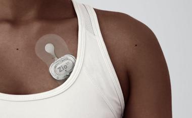 Wearable heart monitor detects of atrial fibrillation early