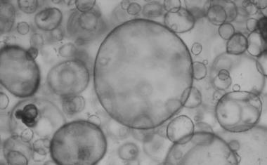 To be or not to be an organoid