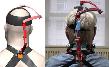 Robotic neck brace to analyze cancer treatment impacts