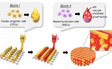 3D-printed cardiac patches for cardiovascular diseases