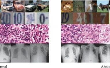 AI spots anomalies in medical images