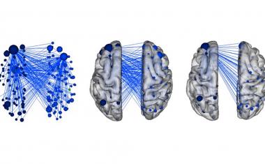 AI reveals brain networks involved in child aggression