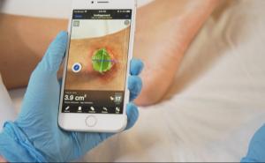 Swift Skin and Wound: App gives touchless measurements