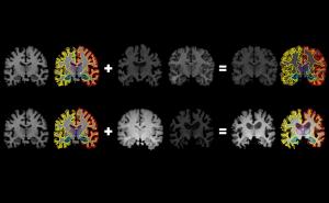 From one brain scan, more information for the AI