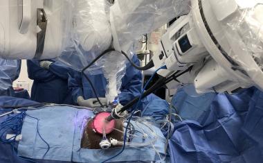 World’s first robotic single-port kidney transplant