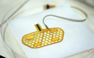 Wearable sensor to help treat swallowing disorders