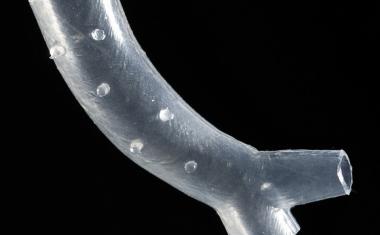 3D printed airway stents approved by FDA