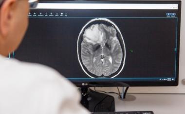 AI may help brain cancer patients avoid biopsy
