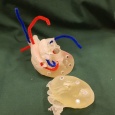Photo: The role of surgical 3D printing in hospitals