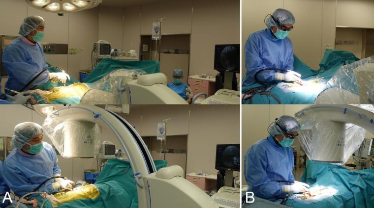 A: The surgeon views the standard fluoroscopic monitor by turning the head away...
