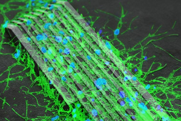 Image of the neuron-delivery microrobot: the cultivation of neurons put on the...