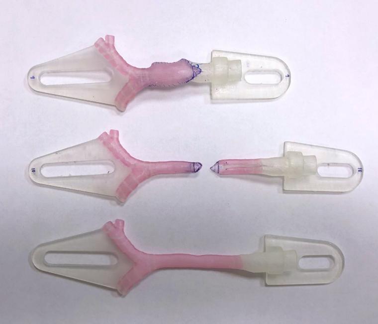 3D-printed models showing virtual surgical planning for a slide tracheoplasty...