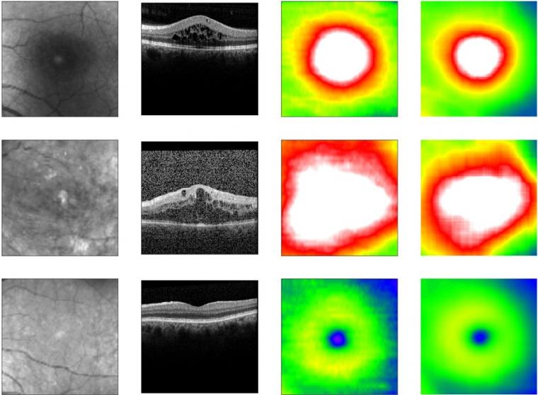 Fundus image, OCT image, true retinal thickness, predicted retinal thickness.