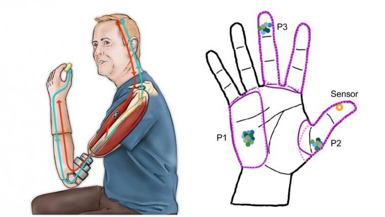 Study participants using the neuroprosthetic device shown in the diagram on the...