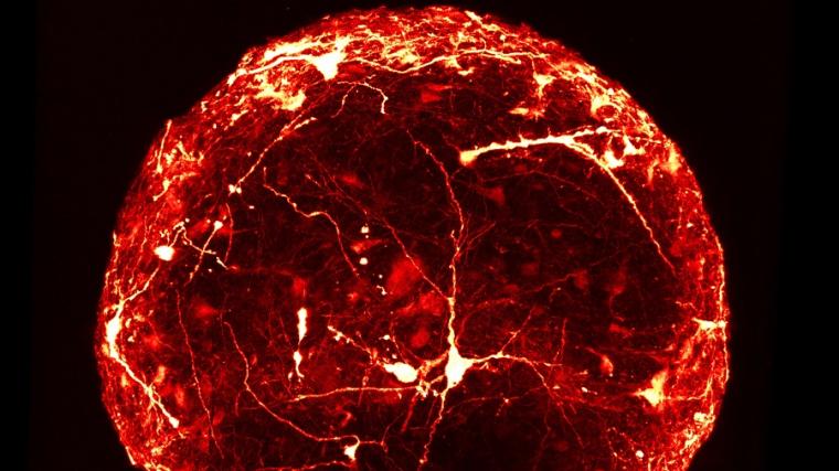 A seven month old 3D mini-brain imaged with a confocal microscope to reveal the...