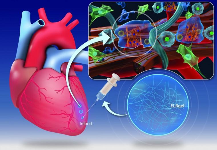 Graphic of heart and injectable hydrogel.