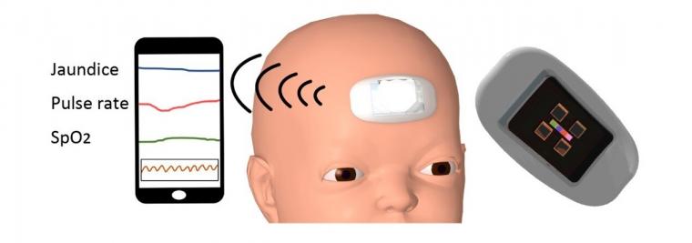Schematic of neonatal wearable device for detecting jaundice and vitals.