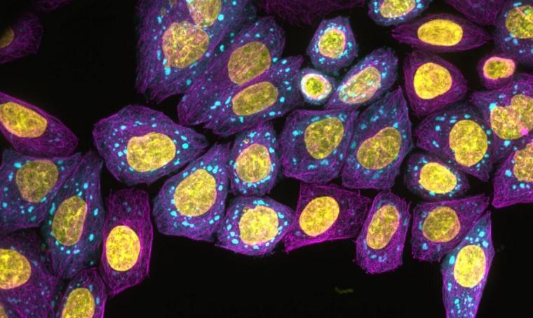 Fluorescence microscopy image of protein condensates forming inside living...