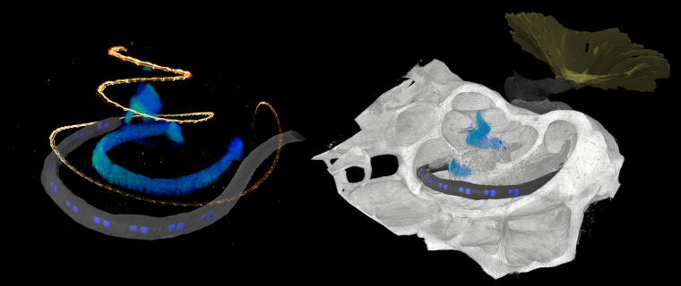 Left: 3D microscopic image of an optical LED-based cochlear implant (blue LEDs...