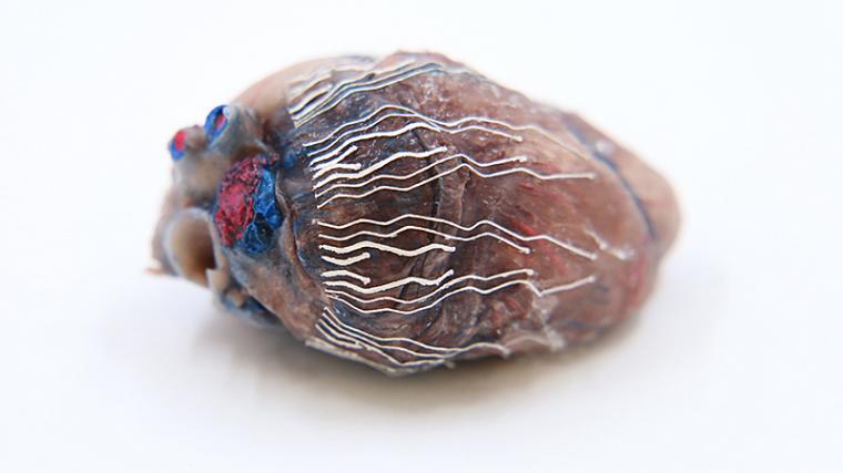 3D-printed sensors allow for simultaneous recording and imaging of tissues and...