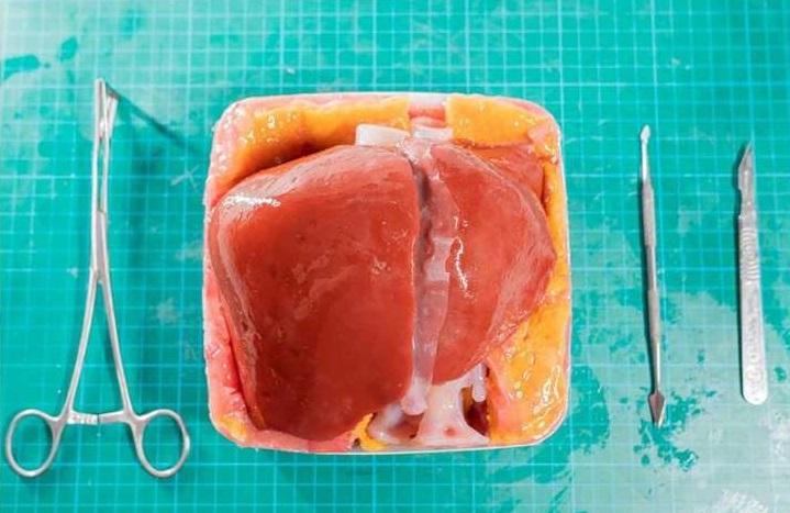 The 3D-printed model liver.