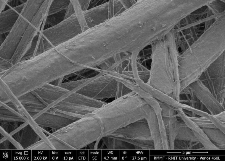 Nanofibres embedded with?flourescent?healing sensors (image magnified 15,000...