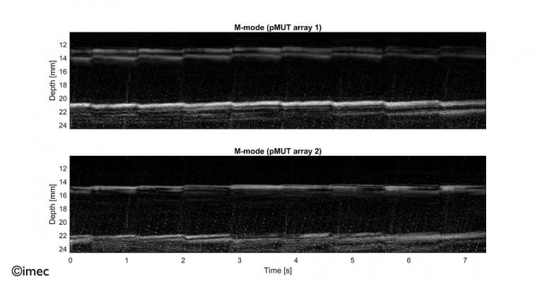 Signal traces obtained by two piezoelectric Micromachined Ultrasound Transducer...