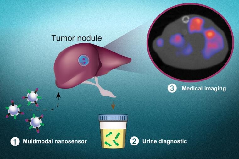 Image shows tests to diagnose cancer