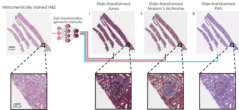 Virtual transformation and re-staining of one tissue biopsy stain (H&E) into...