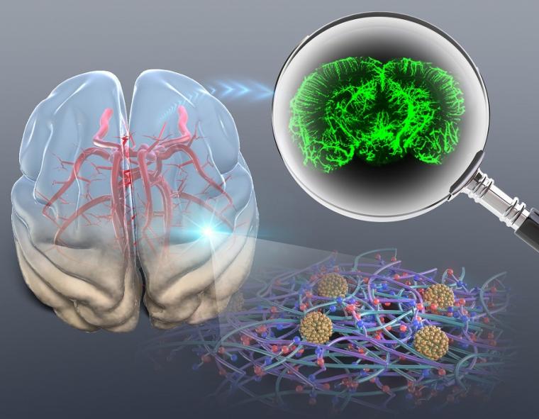 Optical clearing process of a brain tissue to visualize the 3D vascular network...