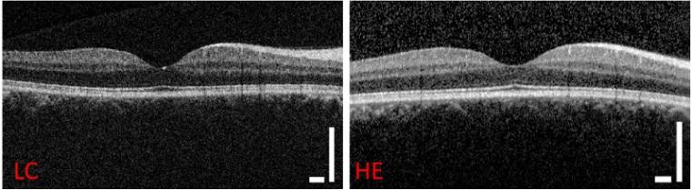 A comparison of retinal images taken by the new low-cost OCT system (left) and...