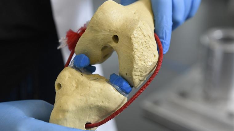 Fisher’s team uses this model of a knee to reproduce the forces faced by the...