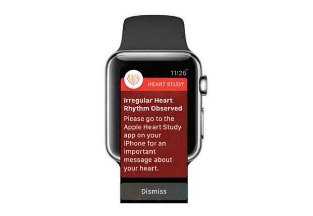 Participants in the Apple Heart Study get a notification like this if the...
