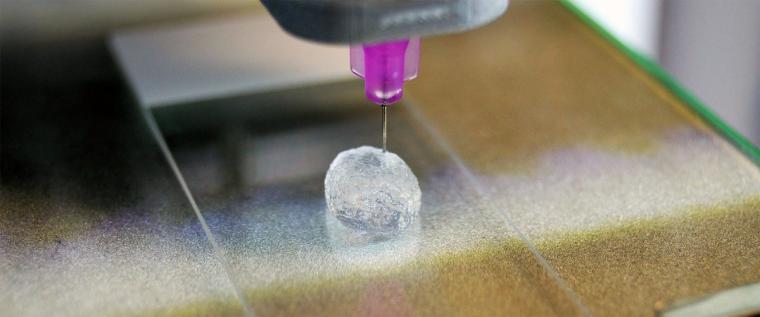 3D printed tumor model shows interaction with immune cells