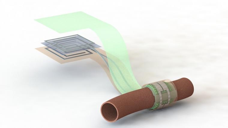 Artist’s depiction of the biodegradable pressure sensor wrapped around a...