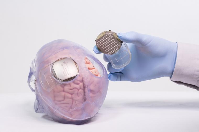 The researchers is the first semi-invasive wireless brain-computer system...