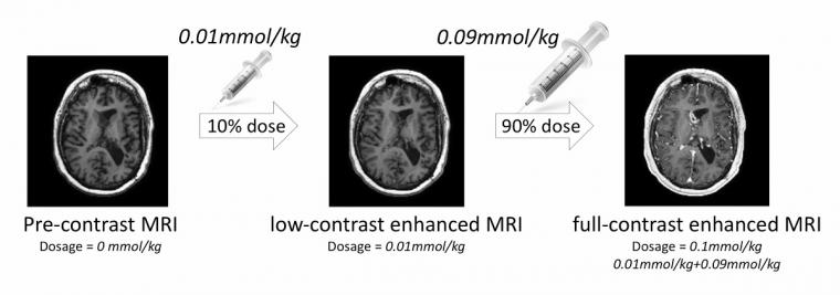 Imaging protocol used with 3 different MR series at different contrast doses.