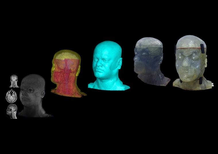 Depiction of the phantom head development. From a 3T MRI dataset and a 3D...