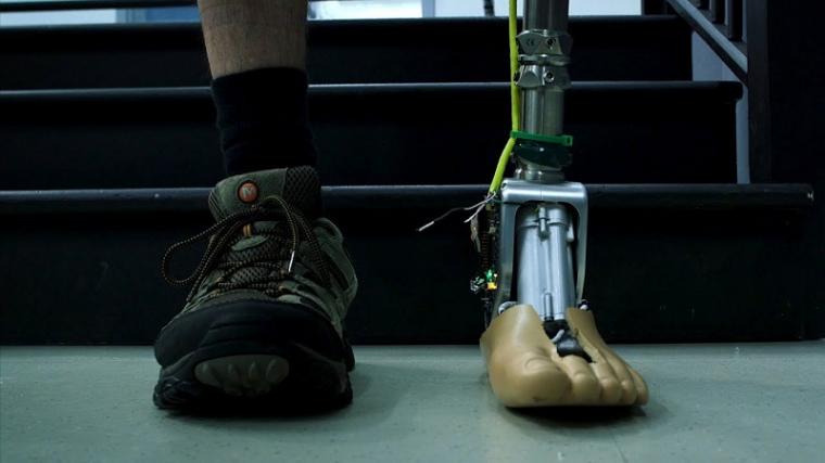Prosthetics for arms and legs have evolved from the rudimentary wooden...